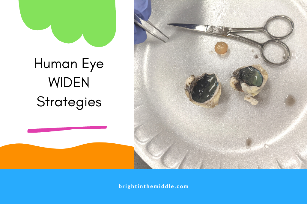 human eye widen strategies - picture of sheep eye dissection